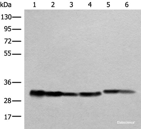 Western blot analysis of Human heart tissue A549 231 Jurkat HEPG2 and Hela cell lysates using ATP5C1 Polyclonal Antibody at dilution of 1:1000