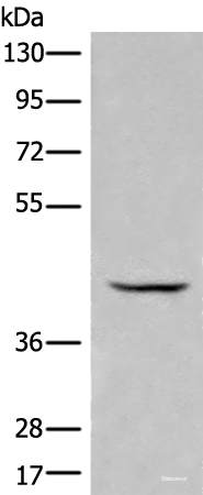 Western blot analysis of Human kidney tissue lysate using BBOX1 Polyclonal Antibody at dilution of 1:650