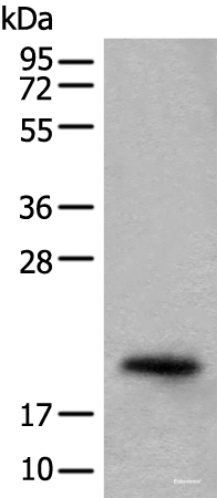 Western blot analysis of Mouse eye tissue lysate using CRYGS Polyclonal Antibody at dilution of 1:800