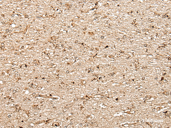 Immunohistochemistry of paraffin-embedded Human brain tissue using MCPH1 Polyclonal Antibody at dilution of 1:40(×200)
