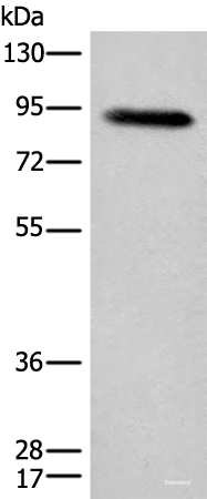 Western blot analysis of Human plasma solution using C1R Polyclonal Antibody at dilution of 1:800