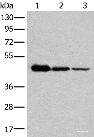 Western blot analysis of HEPG2 Hela and A549 cell lysates using NADK2 Polyclonal Antibody at dilution of 1:600