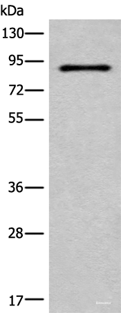 Western blot analysis of HUVEC cell lysate using C7 Polyclonal Antibody at dilution of 1:800