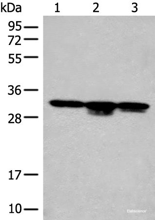 Western blot analysis of RAW264.7 cell Mouse kidney tissue and Mouse heart tissue lysates using CA7 Polyclonal Antibody at dilution of 1:400