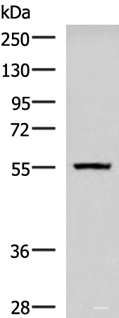 Western blot analysis of Human cerebella tissue lysate using CAMKK1 Polyclonal Antibody at dilution of 1:700