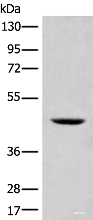 Western blot analysis of 293T cell lysate using SHPK Polyclonal Antibody at dilution of 1:500