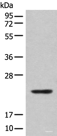 Western blot analysis of Mouse lung tissue lysate using CBFB Polyclonal Antibody at dilution of 1:400