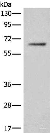 Western blot analysis of Hela cell lysate using CEP57 Polyclonal Antibody at dilution of 1:450