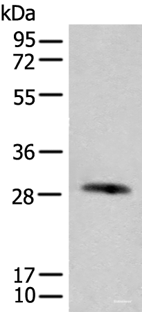 Western blot analysis of Human urinary bladder tissue lysate using CFHR2 Polyclonal Antibody at dilution of 1:550