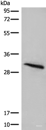 Western blot analysis of Mouse lung tissue lysate using ITM2B Polyclonal Antibody at dilution of 1:400