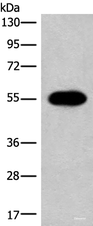 Western blot analysis of A549 cell lysate using HAS3 Polyclonal Antibody at dilution of 1:300
