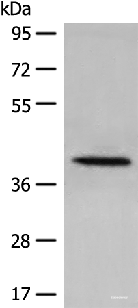 Western blot analysis of 231 cell lysate using DHRS7 Polyclonal Antibody at dilution of 1:400