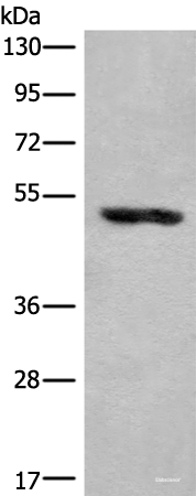 Western blot analysis of Human placenta tissue lysate using KLHDC2 Polyclonal Antibody at dilution of 1:400