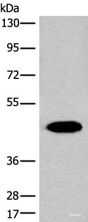 Western blot analysis of Human liver tissue lysate using FAH Polyclonal Antibody at dilution of 1:700