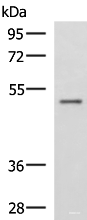 Western blot analysis of Human placenta tissue lysate using GRWD1 Polyclonal Antibody at dilution of 1:800