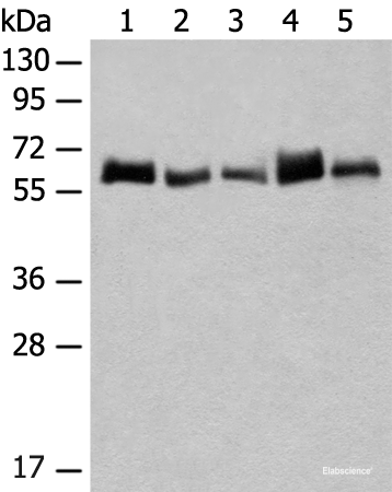 Western blot analysis of K562 and A172 cell Human bladder transitional cell carcinoma grade 2-3 tissue NIH/3T3 cell Mouse liver tissue lysates using CCDC47 Polyclonal Antibody at dilution of 1:300