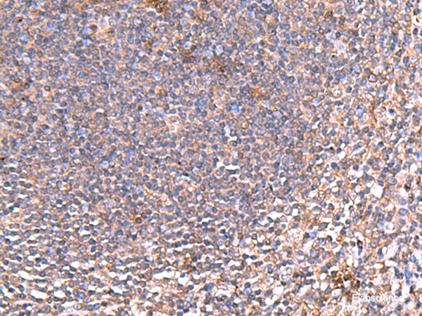 Immunohistochemistry of paraffin-embedded Human tonsil tissue using PDRG1 Polyclonal Antibody at dilution of 1:80(×200)