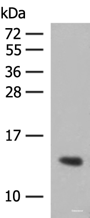 Western blot analysis of Human plasma solution using HBG1:HBG2 Polyclonal Antibody at dilution of 1:350