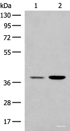 Western blot analysis of HEPG2 and K562 cell lysates using MRM1 Polyclonal Antibody at dilution of 1:400