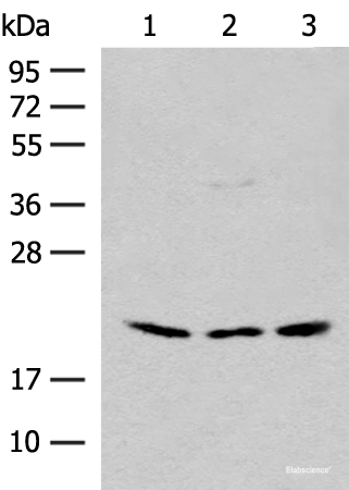 Western blot analysis of HEPG2 and Hela cell Mouse liver tissue lysates using RPL23A Polyclonal Antibody at dilution of 1:300