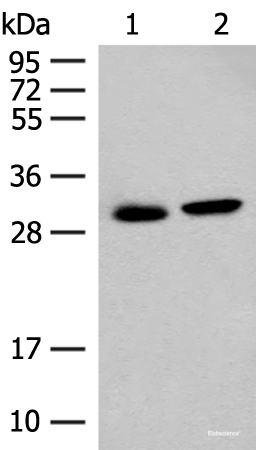 Western blot analysis of Mouse kidney tissue and Human kidney tissue lysates using GLYAT Polyclonal Antibody at dilution of 1:300