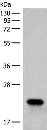 Western blot analysis of Human fetal brain tissue lysate using RAC3 Polyclonal Antibody at dilution of 1:400