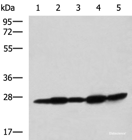 Western blot analysis of Mouse liver tissue Mouse brain tissue Rat brain tissue Rat liver tissue and Human fetal liver tissue lysates using QDPR Polyclonal Antibody at dilution of 1:800