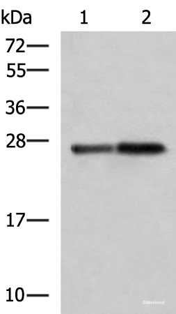 Western blot analysis of Mouse pancreas tissue and Rat pancreas tissue lysates using CTRB1 Polyclonal Antibody at dilution of 1:1000