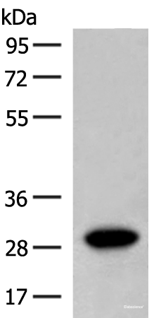Western blot analysis of Human fetal brain tissue lysate using SCGN Polyclonal Antibody at dilution of 1:600