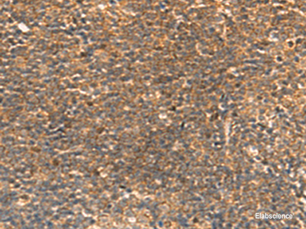 Immunohistochemistry of paraffin-embedded Human tonsil tissue using STK32C Polyclonal Antibody at dilution of 1:30(×200)