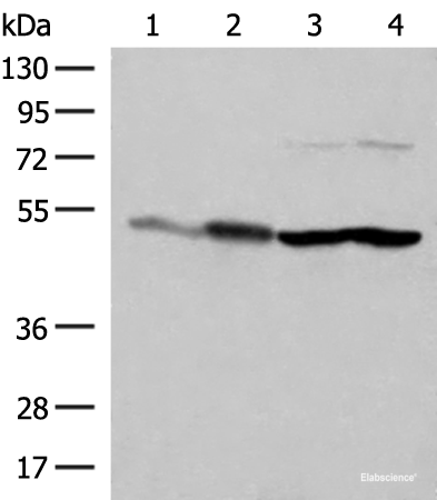 Western blot analysis of Mouse brain tissue HepG2 A375 Hela cell lysates using FLOT2 Polyclonal Antibody at dilution of 1:350