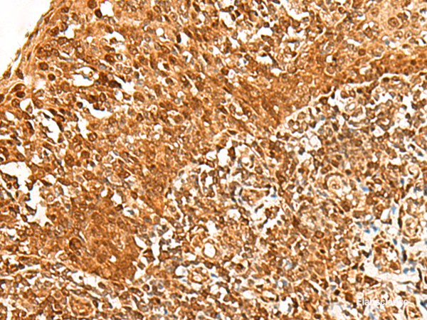 Immunohistochemistry of paraffin-embedded Human tonsil tissue using ADRM1 Polyclonal Antibody at dilution of 1:30(×200)