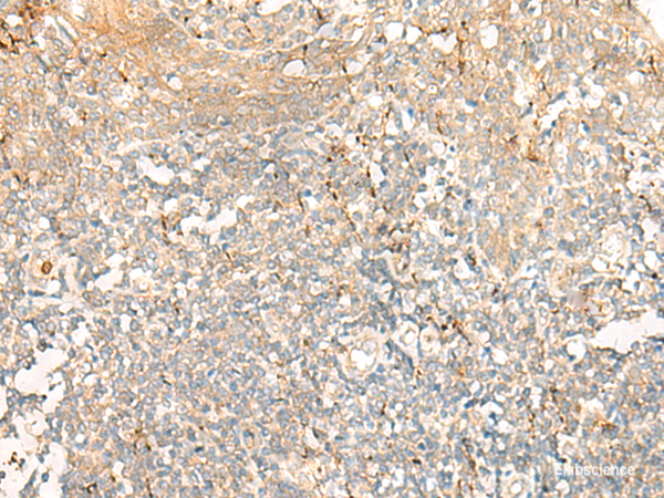 Immunohistochemistry of paraffin-embedded Human tonsil tissue using GCAT Polyclonal Antibody at dilution of 1:60(×200)