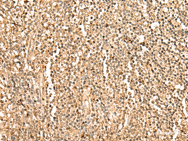 Immunohistochemistry of paraffin-embedded Human tonsil tissue using PPM1G Polyclonal Antibody at dilution of 1:35(×200)