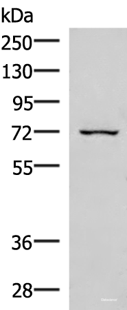 Western blot analysis of 293T cell lysate using EIF2AK1 Polyclonal Antibody at dilution of 1:350
