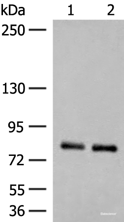 Western blot analysis of Rat brain tissue and Mouse brain tissue lysates using NGEF Polyclonal Antibody at dilution of 1:250
