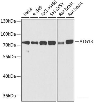 Immunohistochemistry of paraffin-embedded Human placenta using CLUH Polyclonal Antibody at dilution of 1:100 (40x lens).
