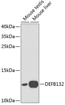 Immunohistochemistry of paraffin-embedded Human colon using c-Jun Polyclonal Antibody at dilution of 1:100 (40x lens).