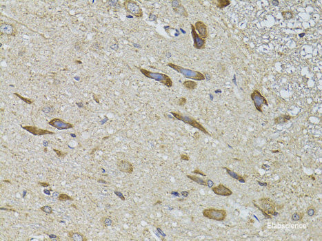 Western blot analysis of extracts of Mouse kidney using VDR Polyclonal Antibody at dilution of 1:1000.