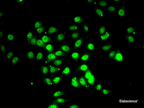 Immunohistochemistry of paraffin-embedded Human colon carcinoma using MTFP1 Polyclonal Antibody at dilution of 1:100 (40x lens).
