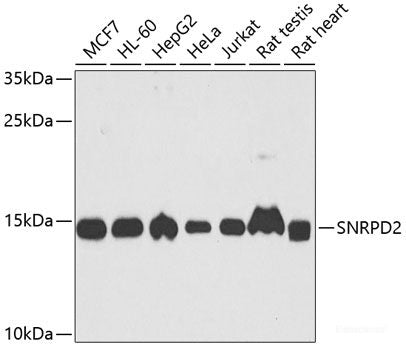 Immunohistochemistry of paraffin-embedded Rat kidney using CSRNP1 Polyclonal Antibody at dilution of 1:200 (40x lens).