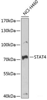 Immunohistochemistry of paraffin-embedded Mouse lung using ALKBH8 Polyclonal Antibody at dilution of 1:100 (40x lens).