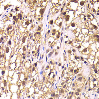 Immunofluorescence analysis of L929 cells using COMMD1 Polyclonal Antibody at dilution of 1:100. Blue: DAPI for nuclear staining.
