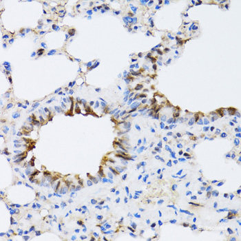 Immunohistochemistry of paraffin-embedded Mouse kidney using CNPY3 Polyclonal Antibody at dilution of 1:100 (40x lens).
