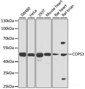 Immunohistochemistry of paraffin-embedded Rat brain using EPHA2 Polyclonal Antibody at dilution of 1:100 (40x lens).