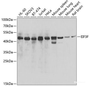 Immunohistochemistry of paraffin-embedded Human colon carcinoma using IDH2 Polyclonal Antibody at dilution of 1:100 (40x lens).