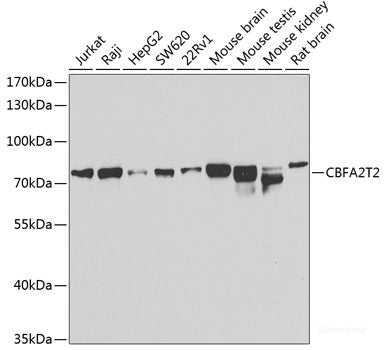 Immunohistochemistry of paraffin-embedded Rat kidney using NAT8B Polyclonal Antibody at dilution of 1:200 (40x lens).