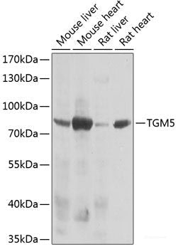 Immunohistochemistry of paraffin-embedded Rat lung using RSRC1 Polyclonal Antibody at dilution of 1:100 (40x lens).