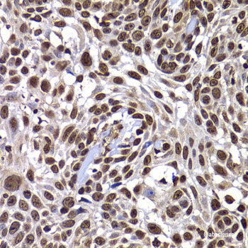 Immunohistochemistry of paraffin-embedded Human liver damage using TOB2 Polyclonal Antibody at dilution of 1:100 (40x lens).