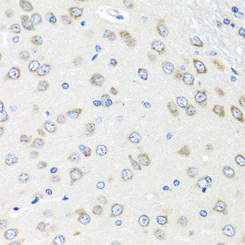 Immunohistochemistry of paraffin-embedded Rat testis using DNMT3B Polyclonal Antibody at dilution of 1:100 (40x lens).
